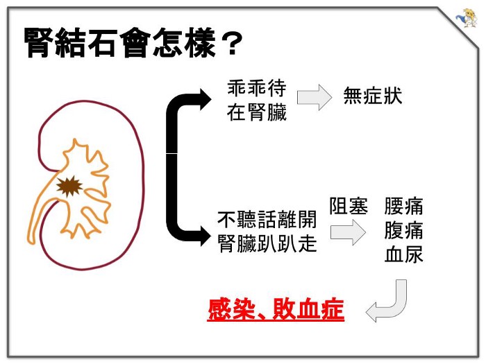 腎結石會怎樣?