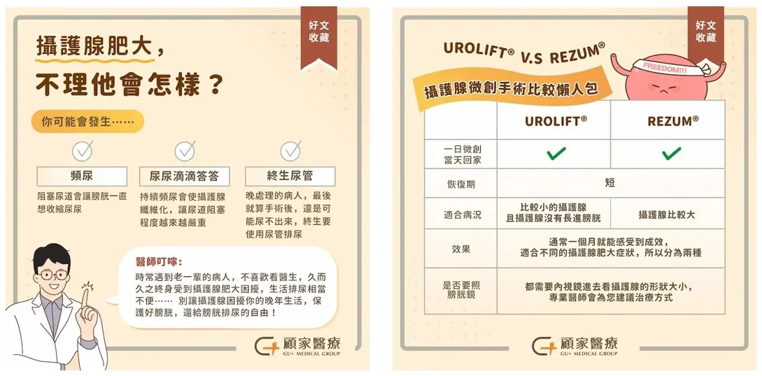 攝護腺肥大手術懶人包總結