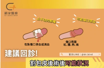 割包皮術後建議回診狀況