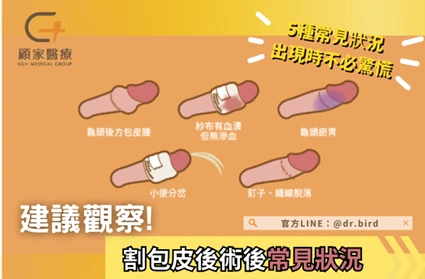割包皮術後建議觀察的常見狀況