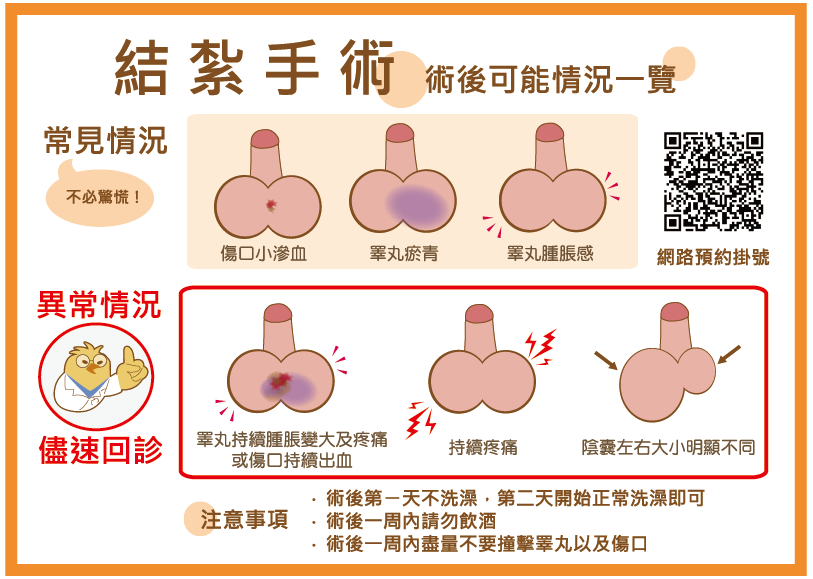 結紮術後可能情況一覽與異常情況
