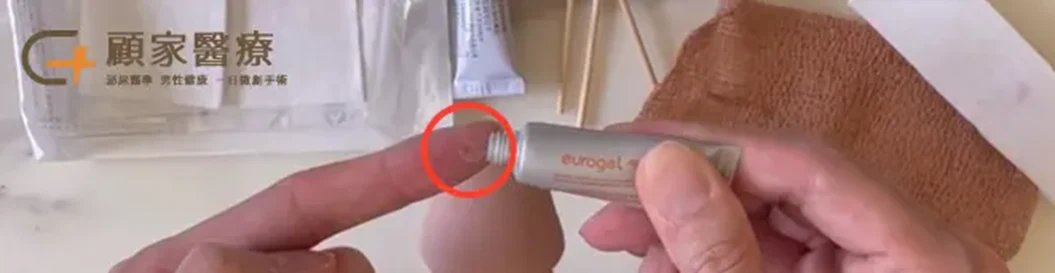 割包皮疤痕色差解決