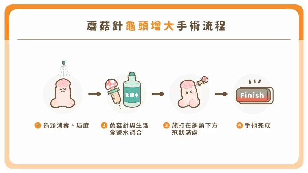 蘑菇針龜頭增大術手術流程