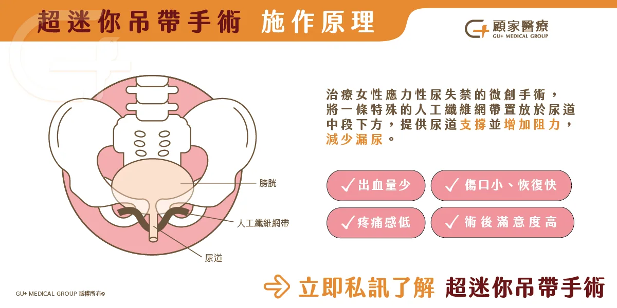 尿失禁-超迷你吊帶手術